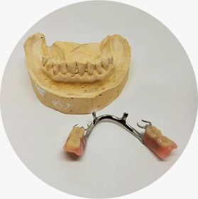 Chrome Cobalt Dentures